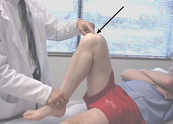屈膝時膝蓋疼痛是人們訪問創傷醫生的最常見原因。 