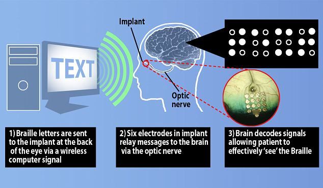 科學家可以讓盲人回到視線